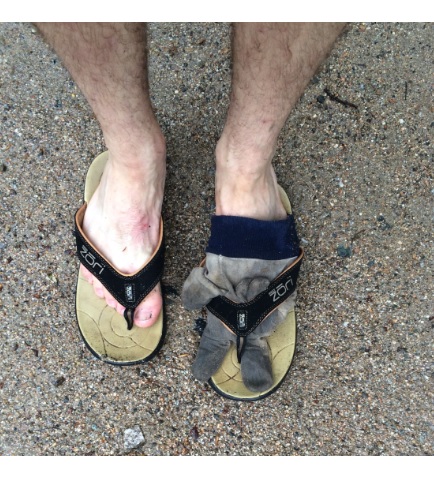 2014-05-23 FR 16;52 Bruised Feet